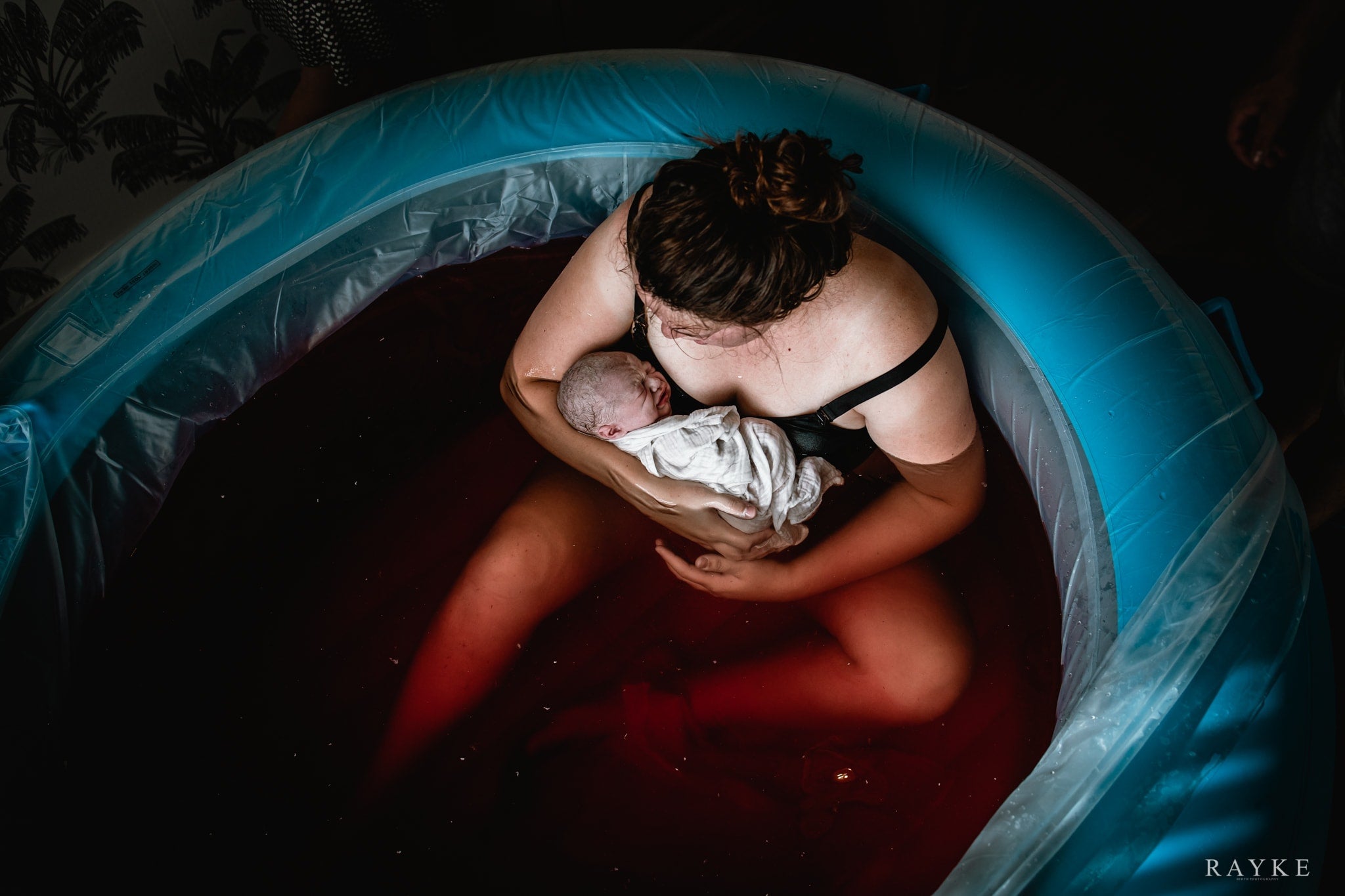 Estimating blood loss during a water birth